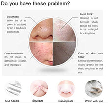 Load image into Gallery viewer, Microcrystaline Blackhead Remover